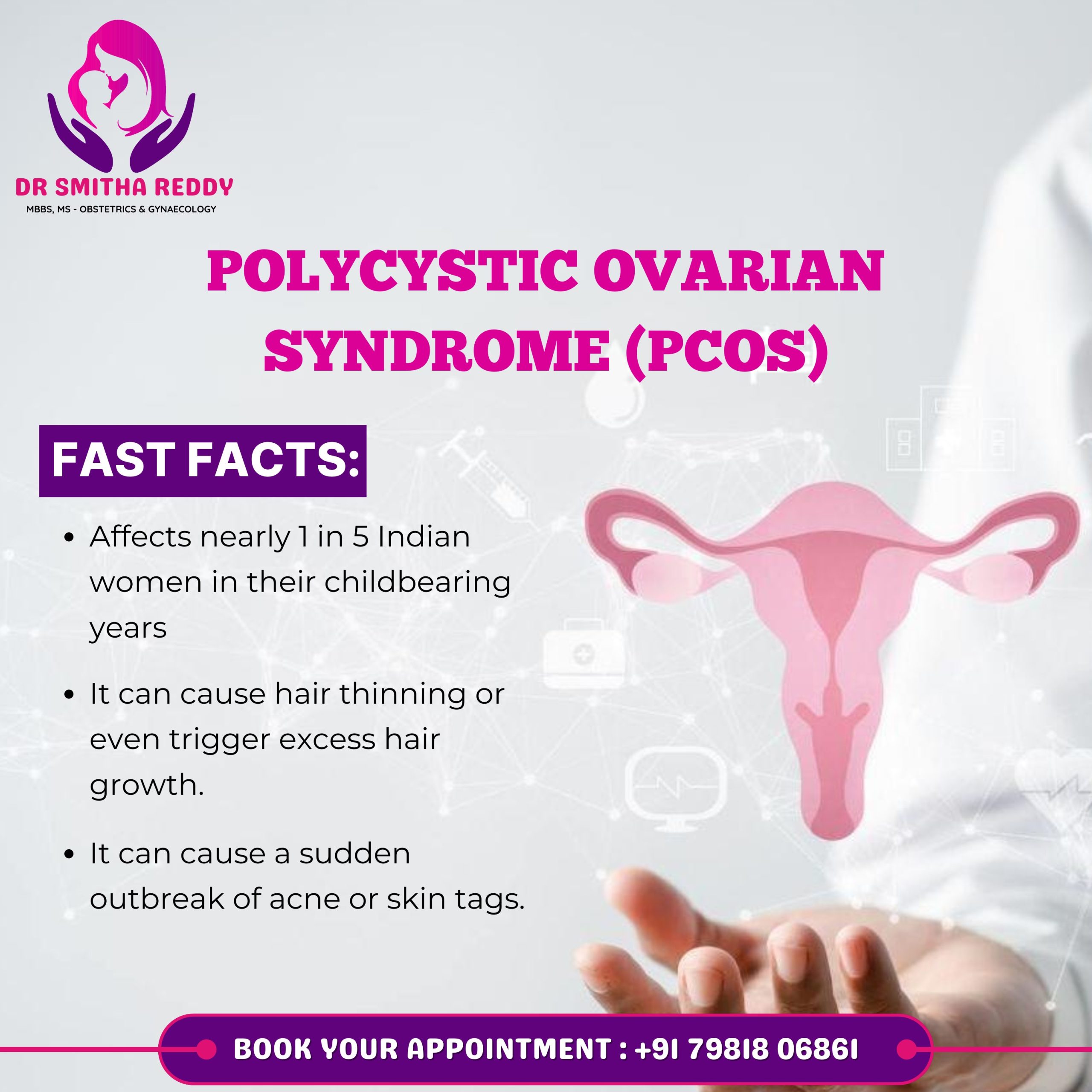 Dr Smitha Reddy-1. PCOS