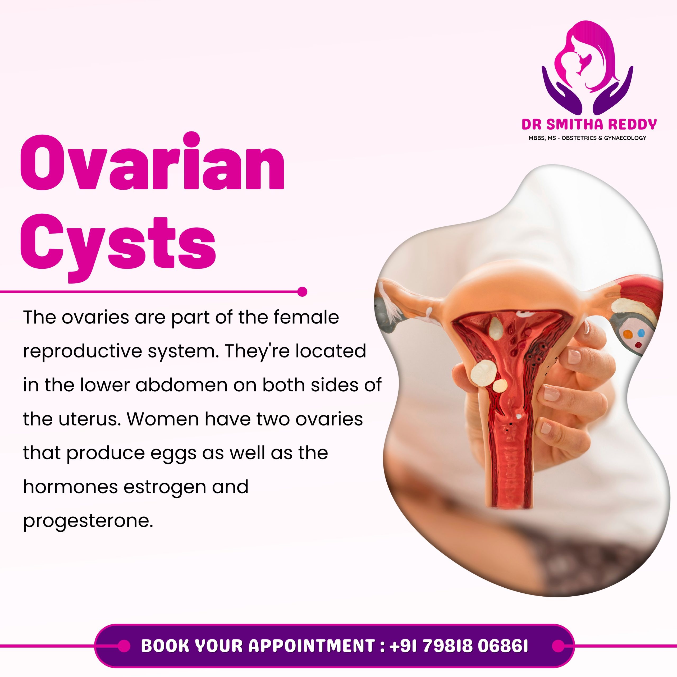 Dr Smitha Reddy - 4. Ovarian Cysts
